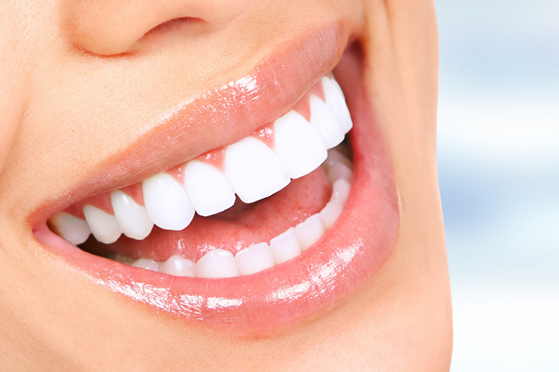 Cosmetic Dentistry in Rancho Park, Century City - Los Angeles