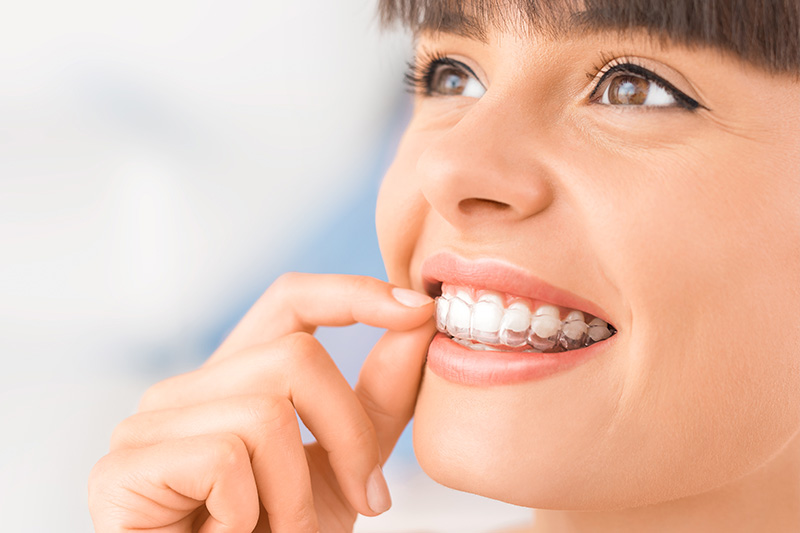 Invisalign in Rancho Park, Century City - Los Angeles